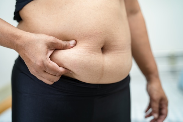 overvaegtig asiatisk kvinde viser fedt mave